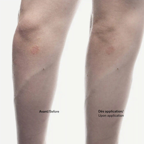 Dry Patch Relief Cream